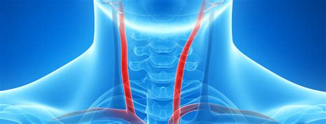 Carotid Endarterectomy Simply Surgical