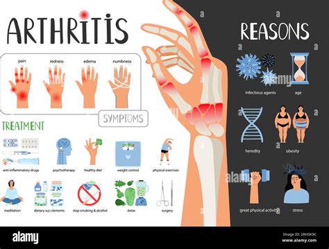 Artritis Reumatoide Vector Cartel M Dico S Ntomas Tratamiento Motivos