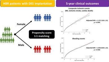 Sex Based Differences In Ischemic Cardiovascular And Bleeding Outcomes