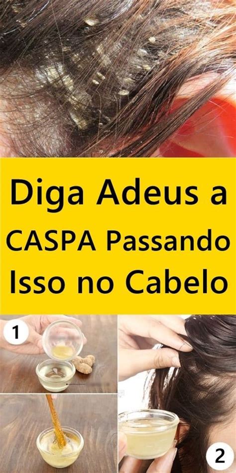 Remédio Caseiro Para Eliminar a Caspa em Até 3 Dias