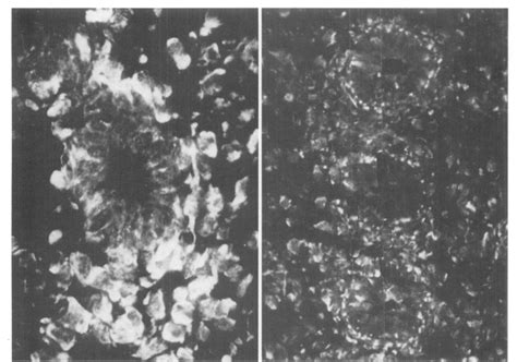 A Left Human Endometrium In Early Proliferative Phase The Great