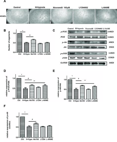 PI3K/AKT/eNOS pathway inhibition blocked the protection of nicorandil ...
