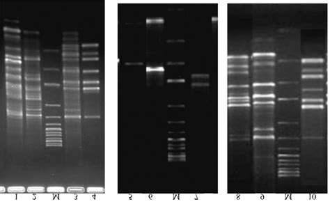 Rapd Pcr Analysis Of Salmonella Strain Dna Fragment Patterns Were