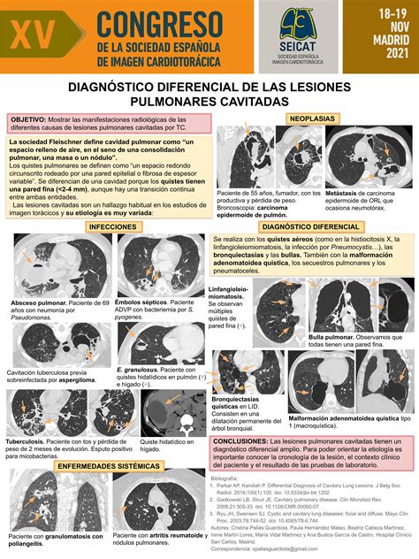 Pdf DiagnÓstico Diferencial De Las Lesiones Pulmonares Pdfslidenet