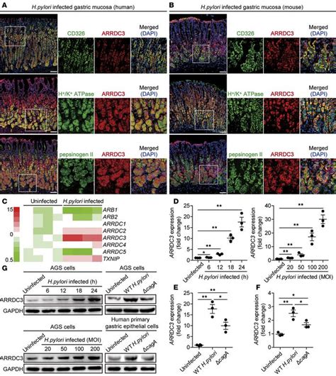 Jci Insight Arrestin Domain Containing Promotes Helicobacter Pylori