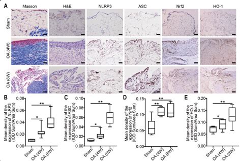 Histology and IHC staining of the synovium in OA model rats. a... | Download Scientific Diagram