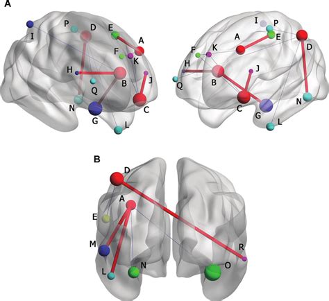 A Brain Functional Connectivity FC Of Rs FMRI In MDD Without CM