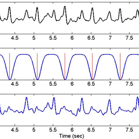 Pcg Spectrogram And Ose Waveforms A Seconds Of Raw Pcg Record