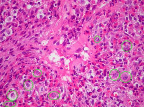 Langerhans Cells Histology