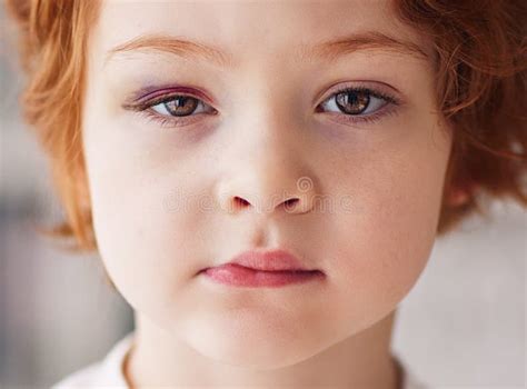 Retrato Detalhado Do Rosto Jovem Um Machucado Roxo No Olho Imagem