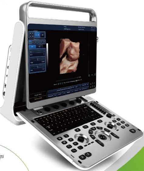 Chison Ultrasound Color Doppler Ultrasound Machine China Chison Color