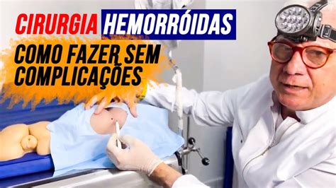 Tipos De Hemorroidas Hemorroida Cirurgia Como Evitar Hemorroidas The