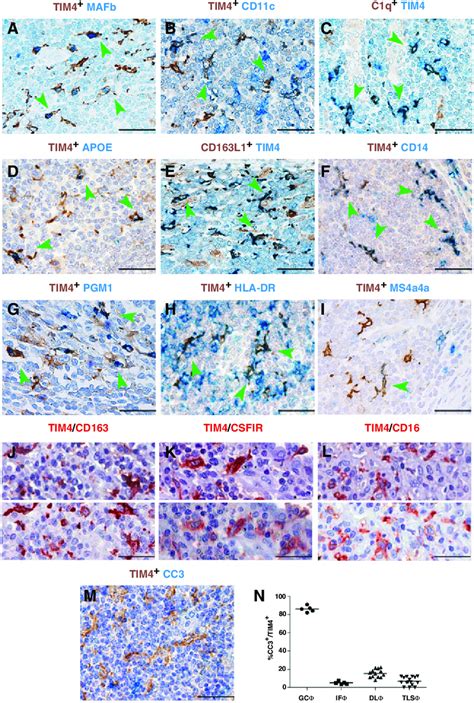 Phenotype Of Tls Tim Macrophages In Human Cancer Sections Are From