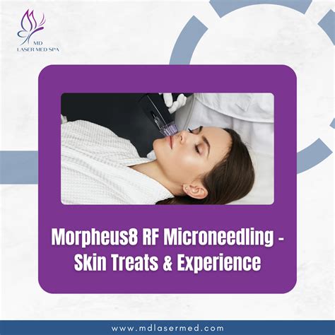 Plano Tx Morpheus8 Rf Microneedling Skin Treats And Experience