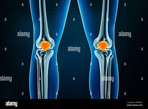 Kneecap Anatomy