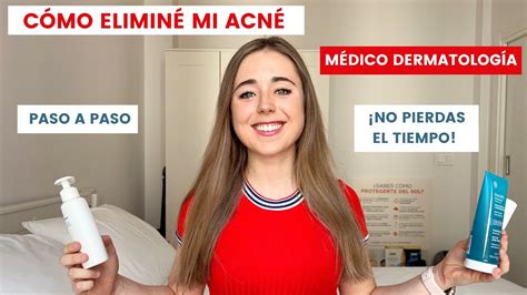 C Mo Elimin Mi Acn Paso A Paso M Dico Dermatolog A C Mo Quitar