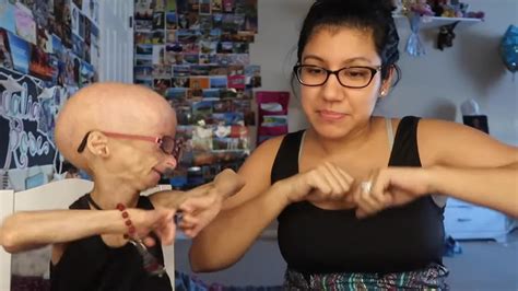 Adalia Rose La Pequeña Youtuber Con Envejecimiento Prematuro Que