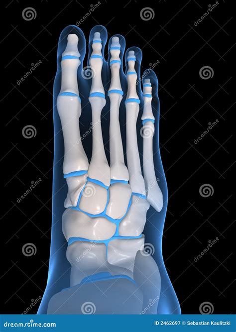 Human Foot Pathology Infographic Flat Foot Anatomy Vector Illustration