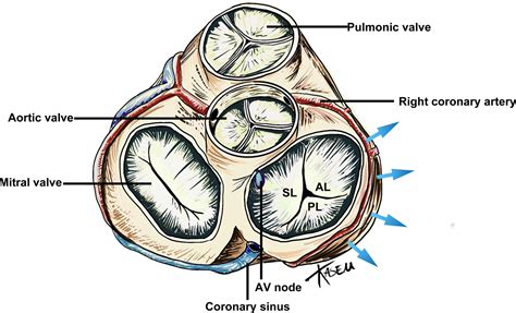 Anatomy Of The Tricuspid Valve And Pathophysiology Of Tricuspid