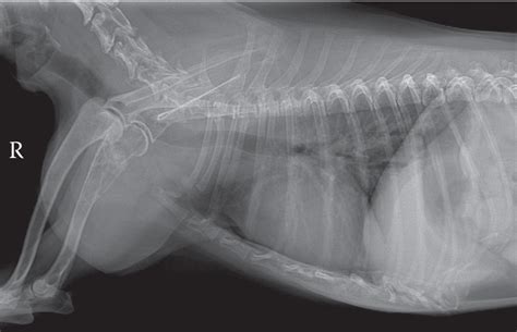 Figure 2 From Atypical Radiographic Features Of Multiple Myeloma In A