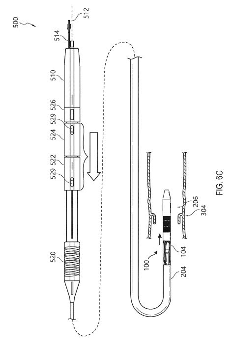 Heart Valve Prosthesis Delivery System Zhang Ji Et Al Suzhou