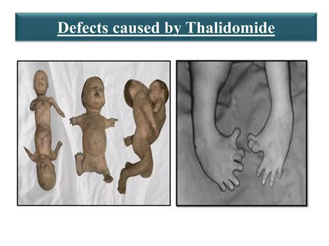 The Thalidomide Tragedypptx