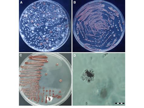 Screening A And Isolation B C Of Yeasts On Ygc Agar Medium With