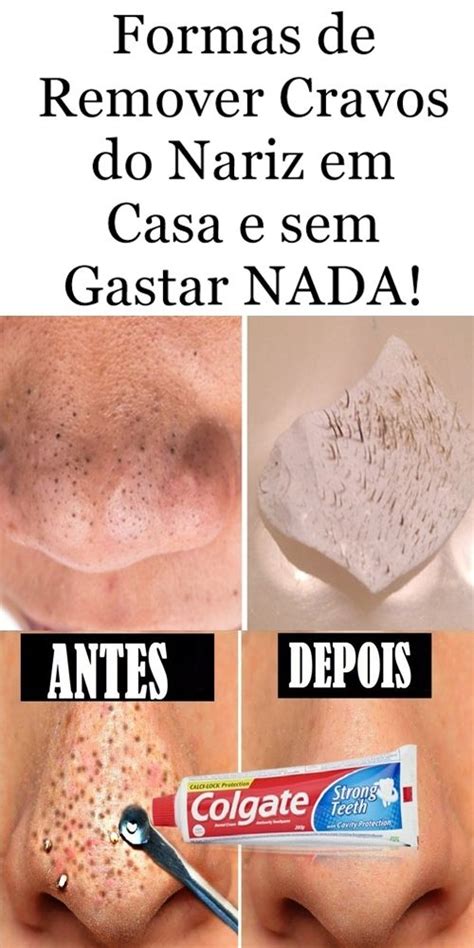 Formas De Remover Cravos Do Nariz Em Casa E Sem Gastar NADA Em 2020