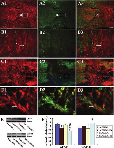 Neurofilament Glial Fibrillary Acidic Protein Nfgfap And