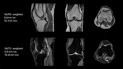 Musculoskeletal Imaging