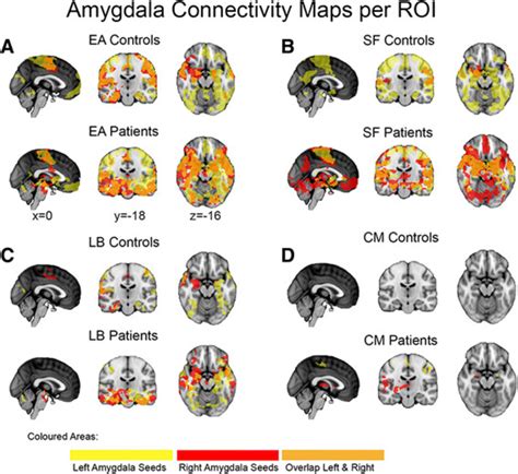 Intrinsic Positive Connectivity Networks Of The Entire Amygdala And Its Download Scientific