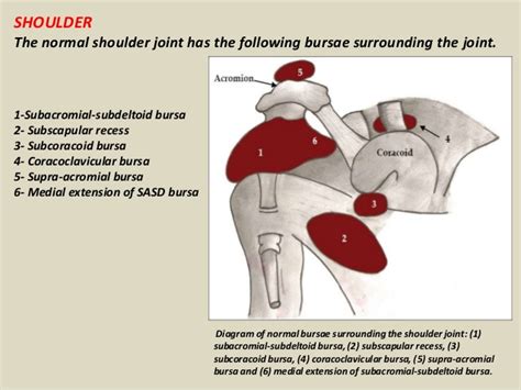 MRI Musculo-Skeletal Section: Bursa of shoulder.