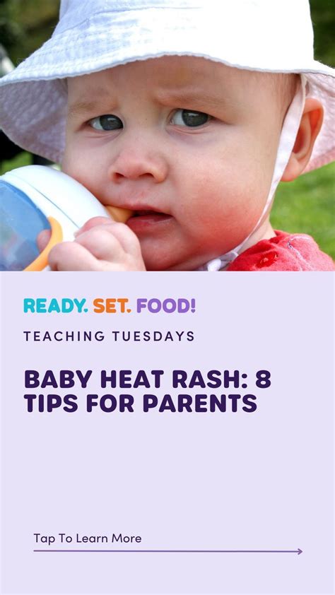 Baby Heat Rash: 8 Tips for Parents | Baby heat rash, Heat rash, Baby