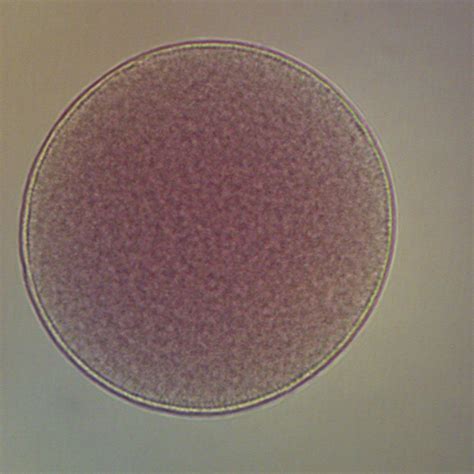 Starfish labeled microscope - honyoo