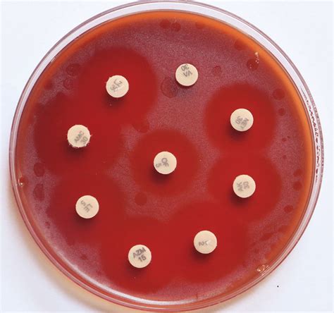 Antimicrobial Susceptibility Test On Sheep Blood Agar Figure