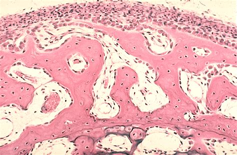 Bone Development: Intramembranous Ossification Tutorial | Sophia Learning