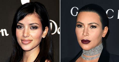 Kim Kardashian Lasered Her 'Hairy Neck,' Forehead: Before, After Pics - Us Weekly