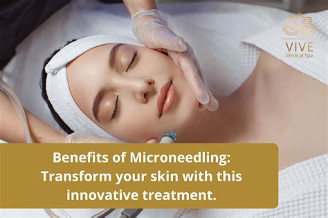 Benefits Of Microneedling Awaken The Natural Beauty Of Your Skin