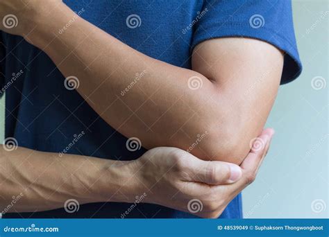 Elbow Bone Fracture Stock Image Image Of Painful Acute 48539049