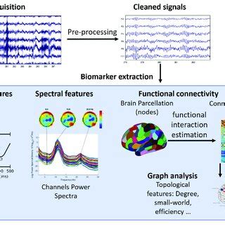 A Schematic Representation Of EEG Signal Processing Workflow And