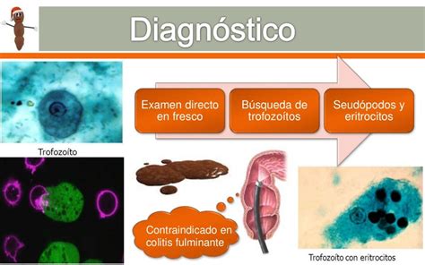 Entamoeba Histolytica Y Giardia Lamblia Diagnóstico Tratamiento Y P