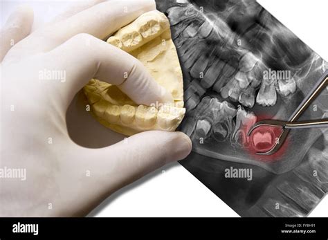 Radiografia Medica Immagini E Fotografie Stock Ad Alta Risoluzione Alamy