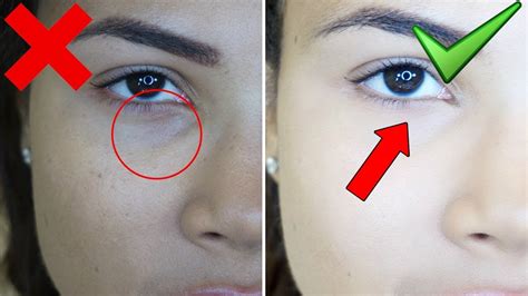 Elimina Las Ojeras Con Este Tratamiento Natural Y Casero Youtube