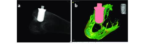 Shows A Micro Ct Reconstruction Image And B Of A Sample With An Download Scientific Diagram