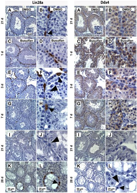 Expression Of Lin28a And Ddx4 In Adult Mouse Testes Following Busulfan