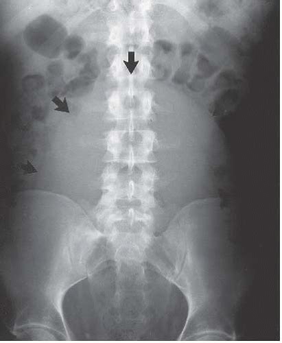 The Urinary Bladder Radiology Key