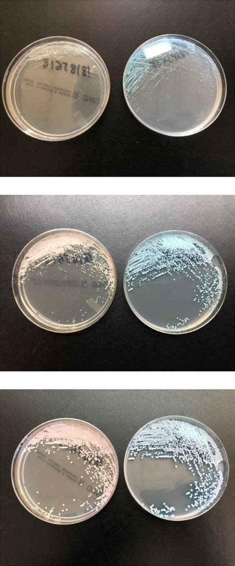 C Auris Culture In Chromagar™ Candida Medium Left Colonies White