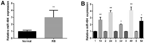 Upregulation Of MiR494 In RB Tissue Samples A Average Expression