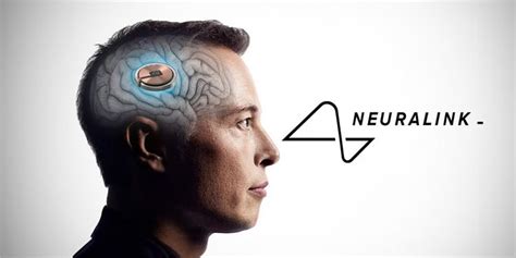 Elon Musk N Beyin Implant Neuralink Insan Denemeleri I In Fda Onay