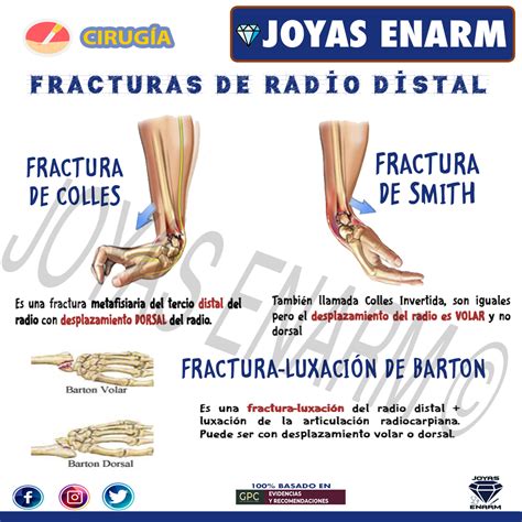 Joyas Enarm On Twitter Repaso Ortopedia Enarm Encuentra El Tema